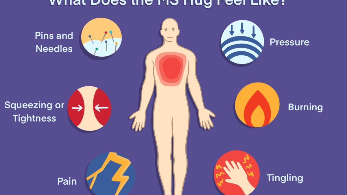 The MS hug: Symptoms, triggers, treatments, and tips to manage