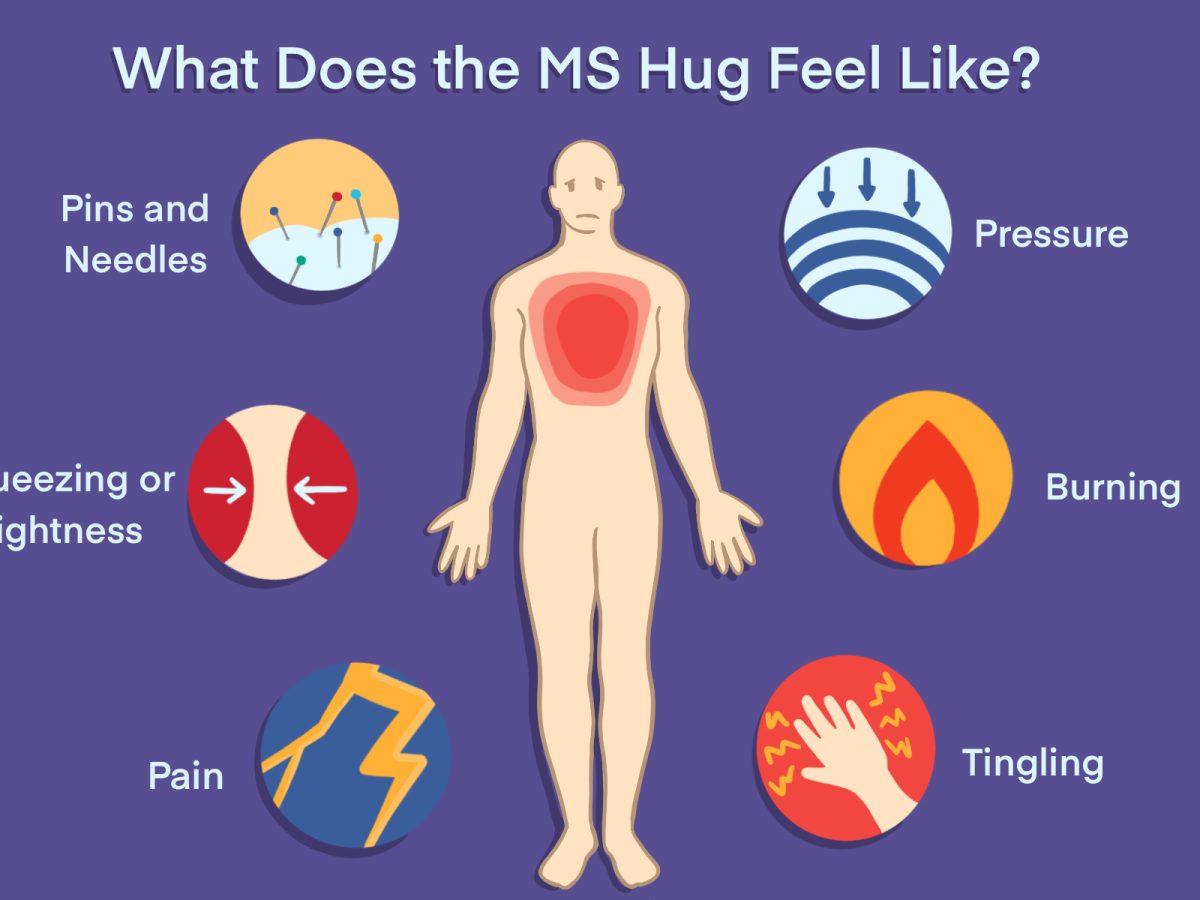 The MS hug: Symptoms, triggers, treatments, and tips to manage