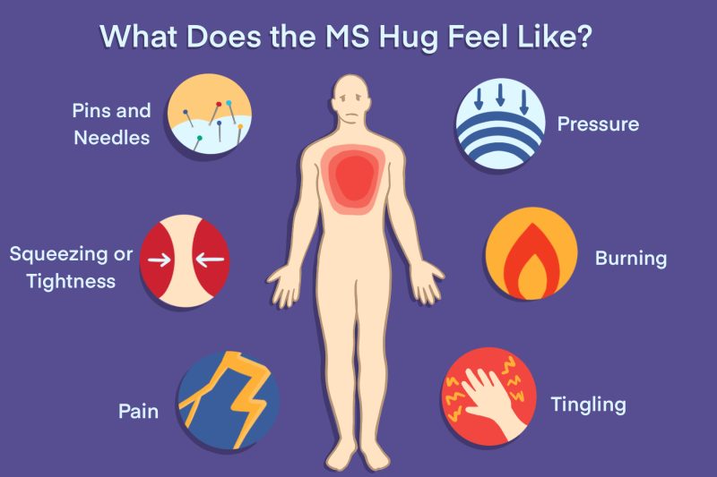 MS hug | Multiple Sclerosis News Today | infographic depicting what the MS hug feels like