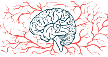 An illustration shows a profile of the human brain amid a host of blood vessels.