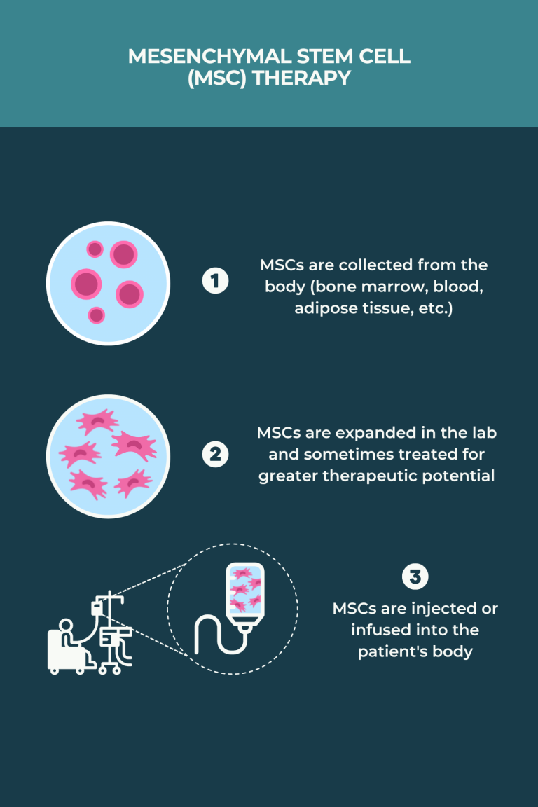 Stem cell therapy for MS | Multiple Sclerosis News Today