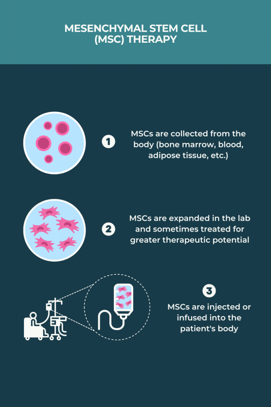 stem cell therapy for MS | Multiple Sclerosis News Today | infographic depicting MSC therapy