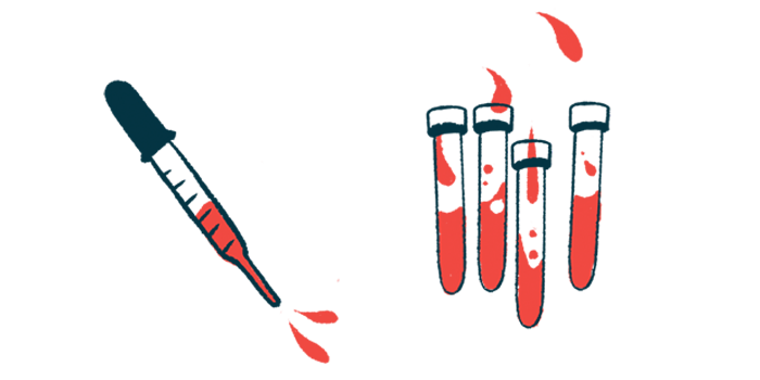 A dropper filled with blood is next to four half-filled vials.