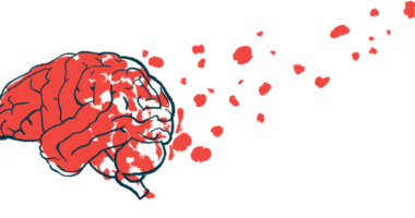 An illustration shows a profile image of a damaged brain.