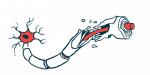 An illustration shows damaged myelin along a nerve cell fiber.