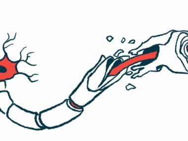An illustration shows damaged myelin along a nerve cell fiber.