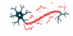 An illustration shows damaged myelin.