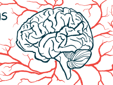 In this profile image, a human brain is surrounded by a network of blood vessels.