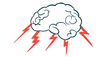 Lightning bolts are pictured shooting out from a human brain.