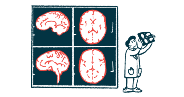 Illustration of a medical professional viewing a brain scan with giant brain scan images in the background.