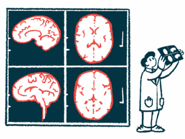 Illustration of a medical professional viewing a brain scan with giant brain scan images in the background.