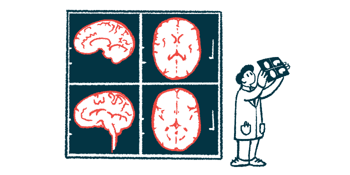 Illustration of a medical professional viewing a brain scan with giant brain scan images in the background.