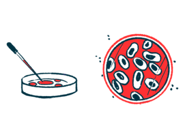 Two views of a Petri dish are shown in this illustration.