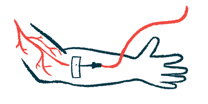 An illustration shows a close-up view of an intravenous infusion into a person's right arm.