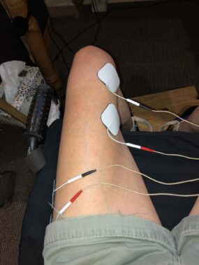 A close-up of the upper part of a leg, with a bended knee at the top of the frame. The leg has various electrodes affixed to it to deliver what's known as neuromuscular electrostimulation. 