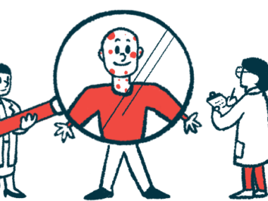 A person covered in red dots is shown under a large magnifying glass as a person in a white coat takes notes.