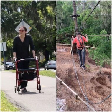 Two side-by-side photos show a woman before and after her stem cell transplant for MS. On the left, she is walking on a sidewalk with a rollator and wearing shaded glasses. On the right, she's navigating a ropes course among the trees.