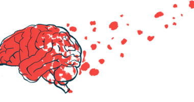 An illustration of the brain is shown.