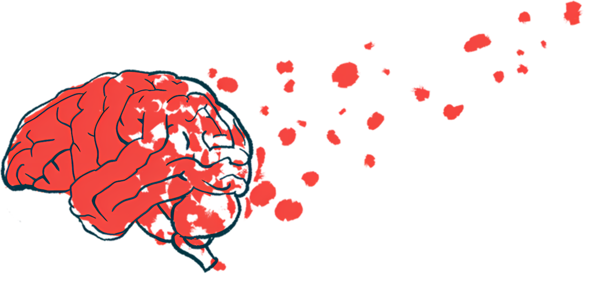 An illustration of the brain is shown.