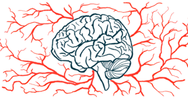 An illustration shows a profile of the human brain amid a host of blood vessels.