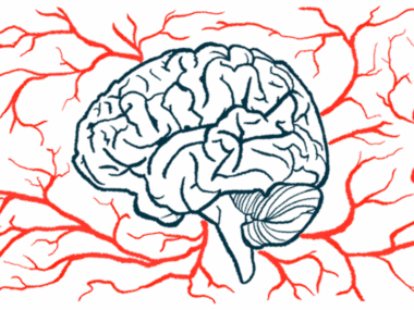 An illustration shows a profile of the human brain amid a host of blood vessels.