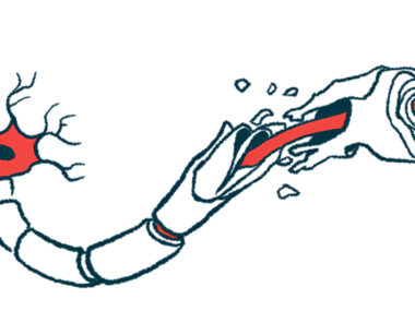 An illustration shows damaged myelin along a nerve cell fiber.