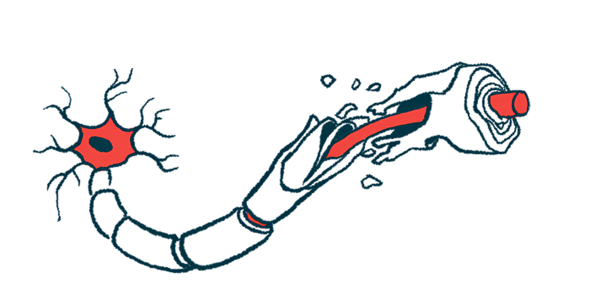 An illustration shows damaged myelin along a nerve cell fiber.