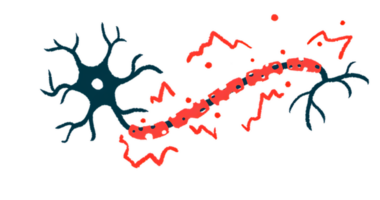 A close-up illustration of damaged myelin.