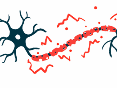 A close-up illustration of damaged myelin.