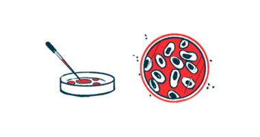 An illustration of a petri dish from two views.