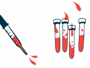 A dropper squirting blood is pictured alongside four half-filled vials.