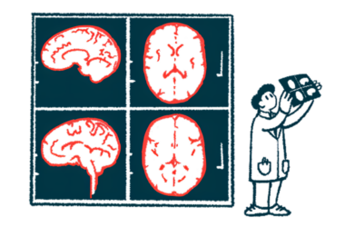 A medical professional views a brain scan with giant brain scan images in the background.