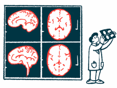 A medical professional views a brain scan with giant brain scan images in the background.