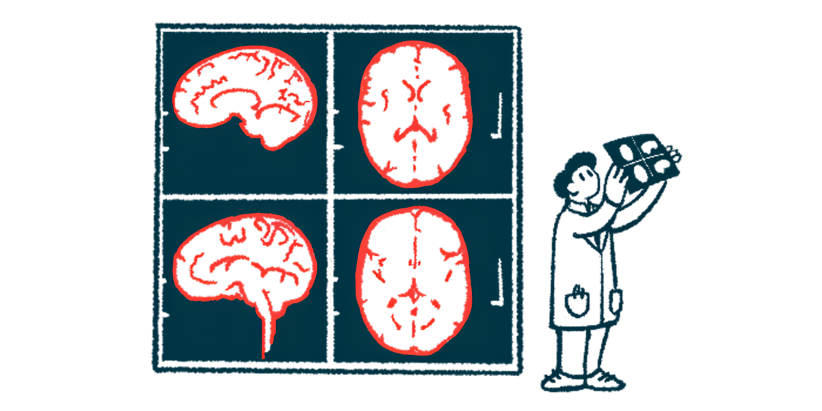 Illustration of a medical professional viewing a brain scan with giant brain scan images in the background.