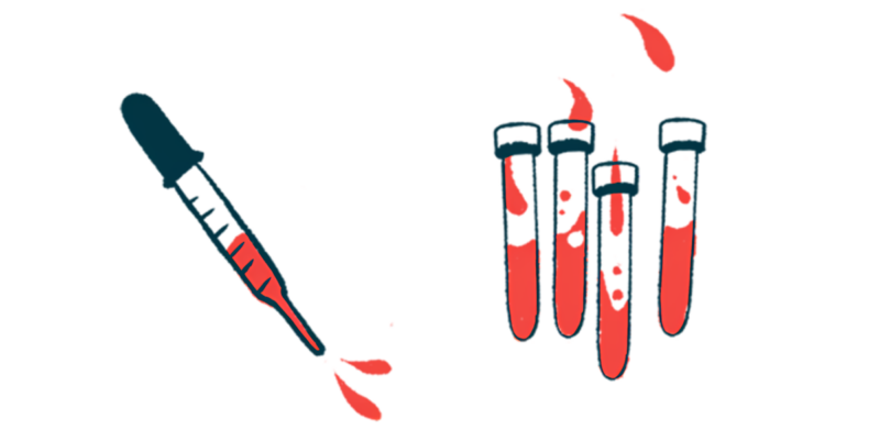 In this illustration, a dropper squirts blood alongside four half-filled vials.