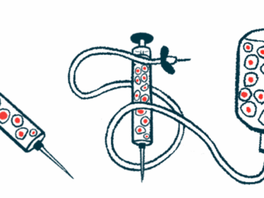 An illustration shows equipment used in stem cell therapy.