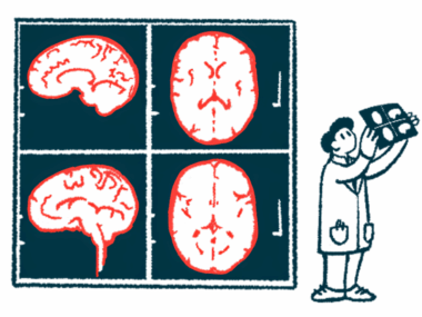 A researcher holds up an image of a brain scan that's projected on a giant nearby screen.