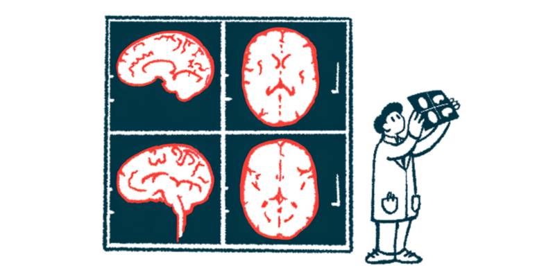 A researcher holds up an image of a brain scan that's projected on a nearby wall.