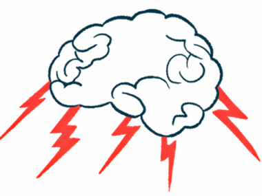 Lightning bolts are pictured shooting out from a human brain.