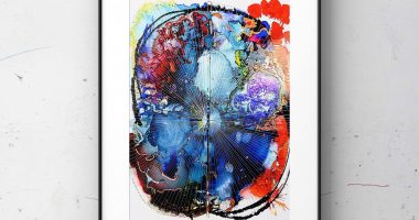 Colors of MS| Multiple Sclerosis News Today | Lindsey Holcomb | artistic rendering of brain MRI