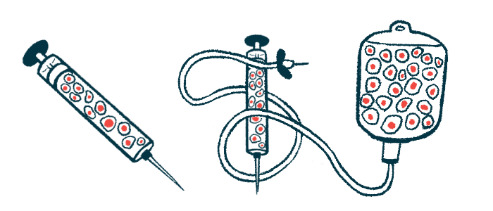 An illustration shows components for stem cell transplant procedure.