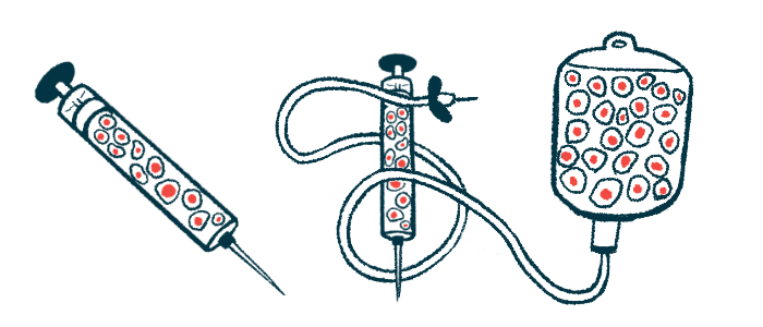 Autologous stem cell transplant safe, effective in RRMS study| Multiple ...