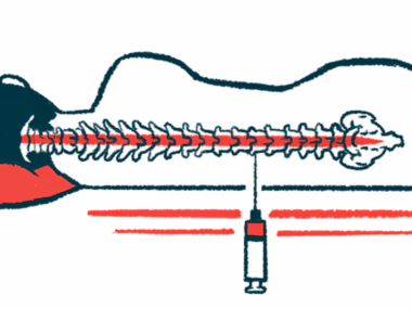 An illustration shows a person receiving an intrathecal injection.
