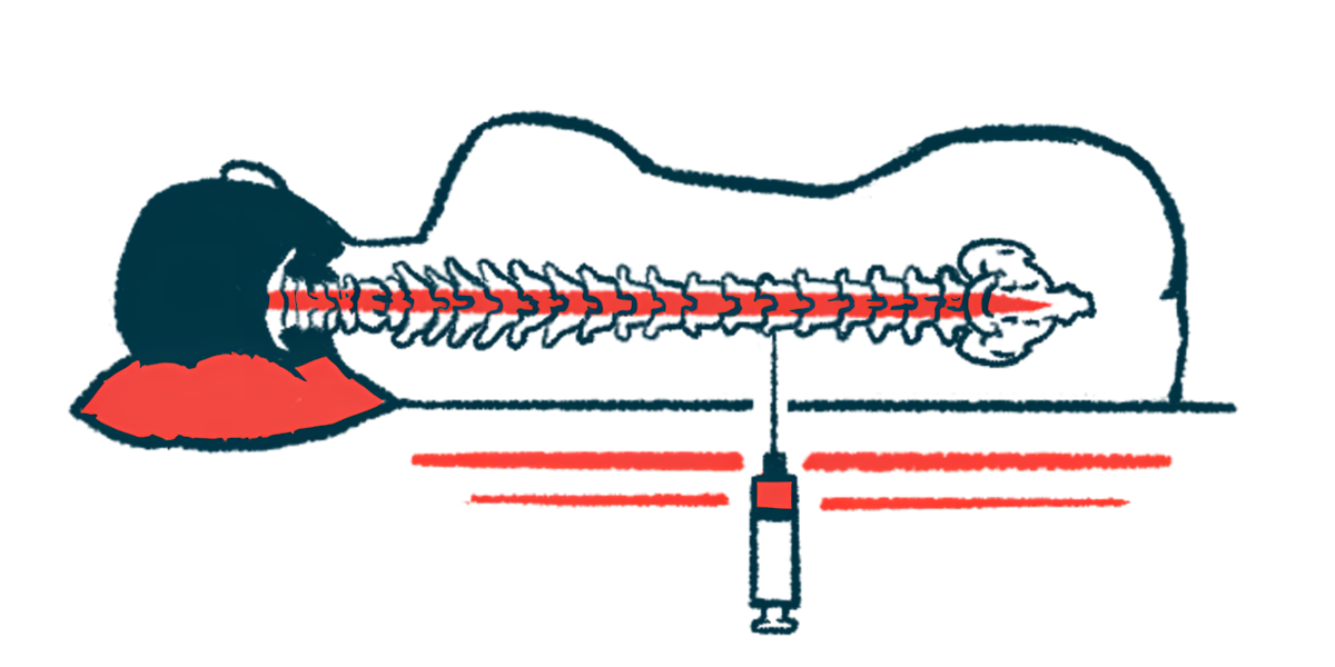 An illustration shows a person receiving an intrathecal injection.
