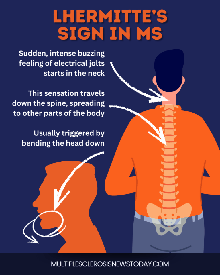 Lhermitte's Sign in MS: Causes and Treatment