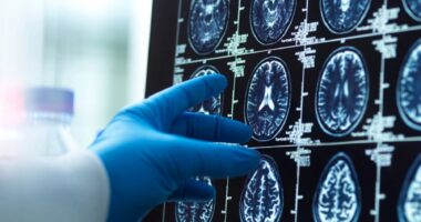 A doctor's gloved hand points to one of many images on a brain scan.