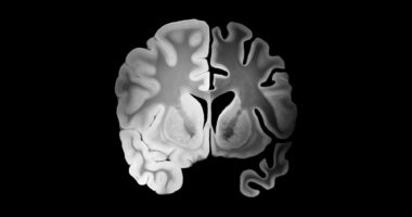 An image of a brain is shown.