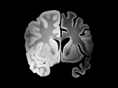 An image of a brain is shown.