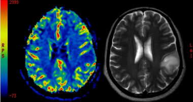 An image of brain scan.