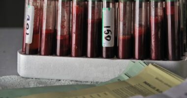 Rack of blood samples.